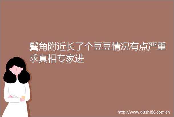 鬓角附近长了个豆豆情况有点严重求真相专家进