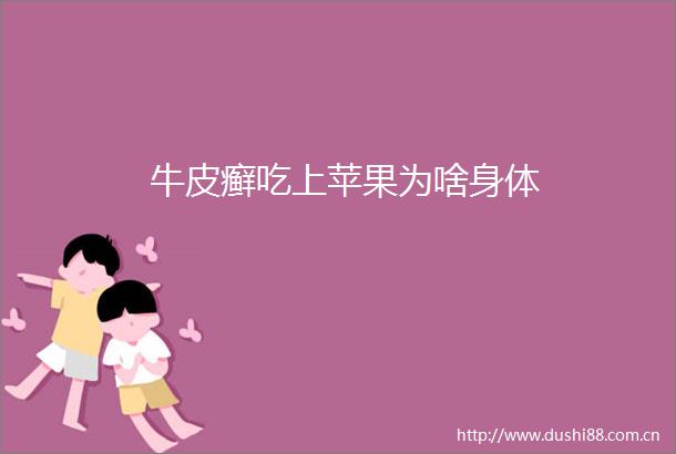 牛皮癣吃上苹果为啥身体