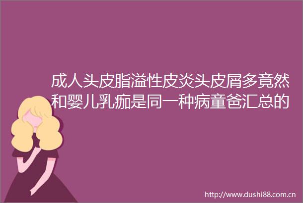 成人头皮脂溢性皮炎头皮屑多竟然和婴儿乳痂是同一种病童爸汇总的关于乳痂和儿童成人脂溢性皮炎的科普文章