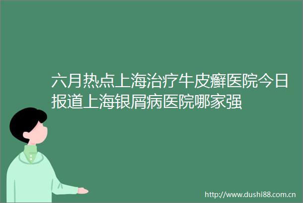 六月热点上海治疗牛皮癣医院今日报道上海银屑病医院哪家强