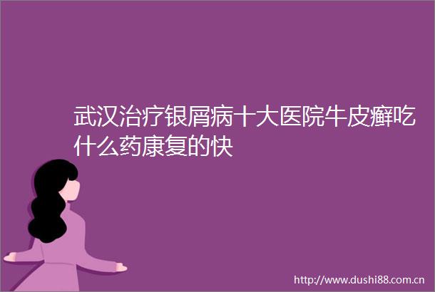 武汉治疗银屑病十大医院牛皮癣吃什么药康复的快