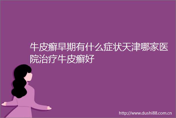 牛皮癣早期有什么症状天津哪家医院治疗牛皮癣好