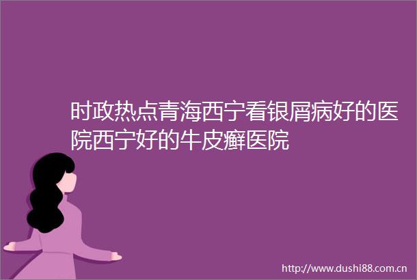 时政热点青海西宁看银屑病好的医院西宁好的牛皮癣医院