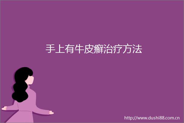手上有牛皮癣治疗方法
