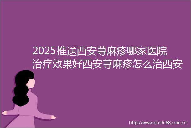 2025推送西安荨麻疹哪家医院治疗效果好西安荨麻疹怎么治西安治疗荨麻疹好的医院西安治疗荨麻疹医院哪家好
