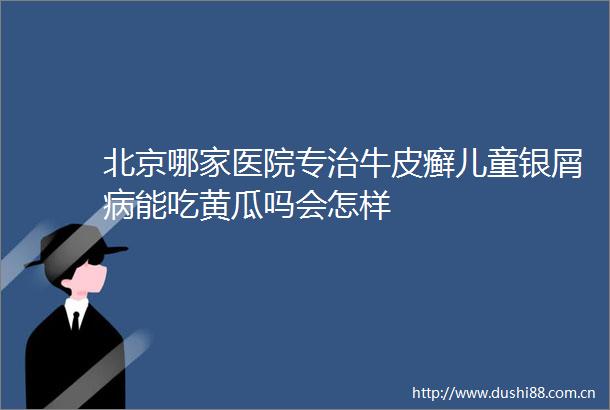 北京哪家医院专治牛皮癣儿童银屑病能吃黄瓜吗会怎样