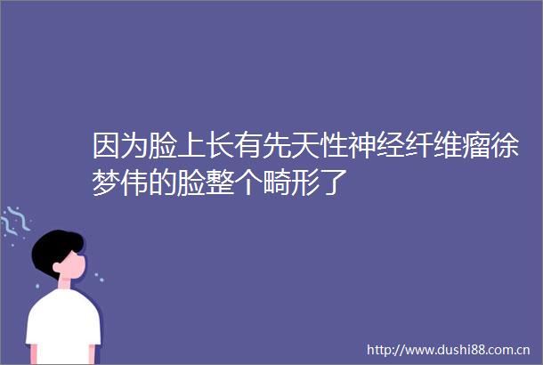 因为脸上长有先天性神经纤维瘤徐梦伟的脸整个畸形了