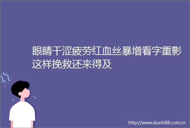 眼睛干涩疲劳红血丝暴增看字重影这样挽救还来得及