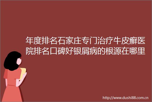 年度排名石家庄专门治疗牛皮癣医院排名口碑好银屑病的根源在哪里