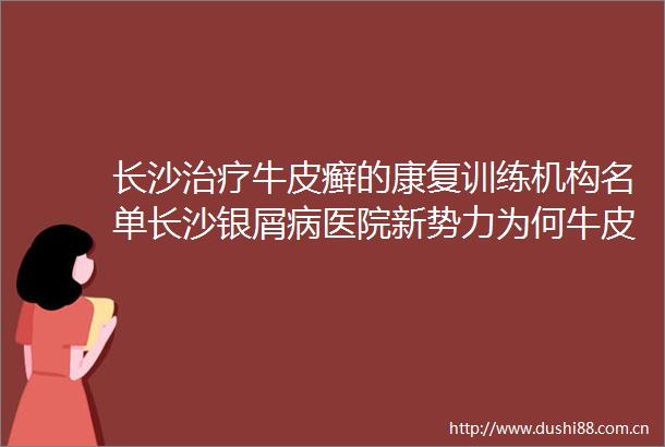 长沙治疗牛皮癣的康复训练机构名单长沙银屑病医院新势力为何牛皮癣患者手心脚心发热