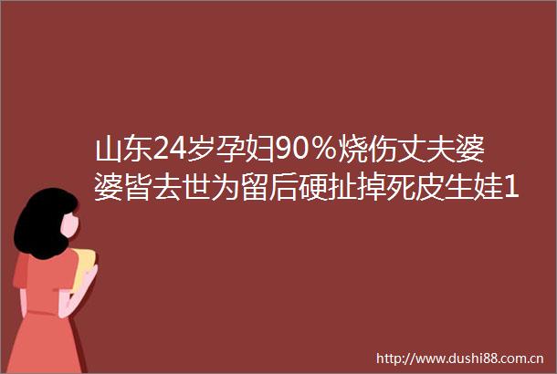 山东24岁孕妇90％烧伤丈夫婆婆皆去世为留后硬扯掉死皮生娃19天后安然离世