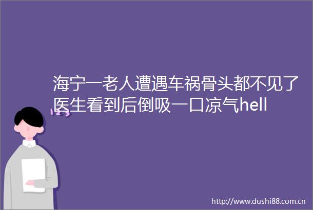 海宁一老人遭遇车祸骨头都不见了医生看到后倒吸一口凉气hellip