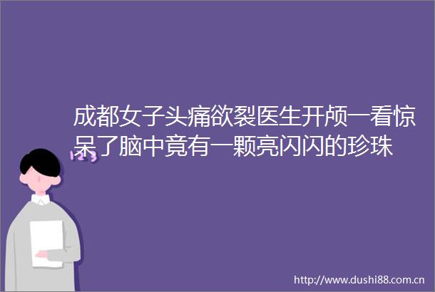 成都女子头痛欲裂医生开颅一看惊呆了脑中竟有一颗亮闪闪的珍珠