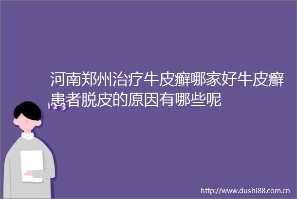 河南郑州治疗牛皮癣哪家好牛皮癣患者脱皮的原因有哪些呢