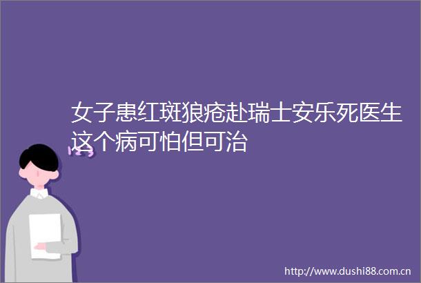 女子患红斑狼疮赴瑞士安乐死医生这个病可怕但可治