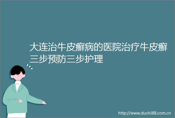 大连治牛皮癣病的医院治疗牛皮癣三步预防三步护理