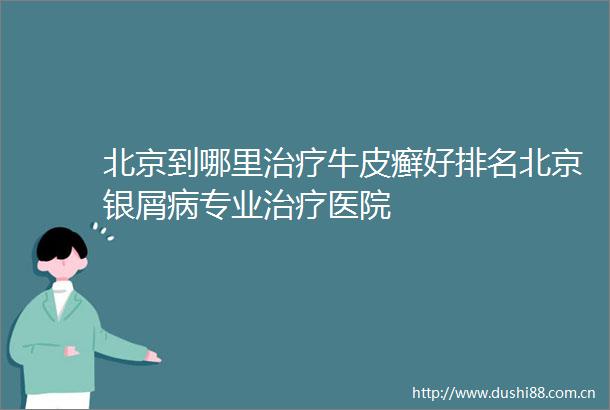 北京到哪里治疗牛皮癣好排名北京银屑病专业治疗医院