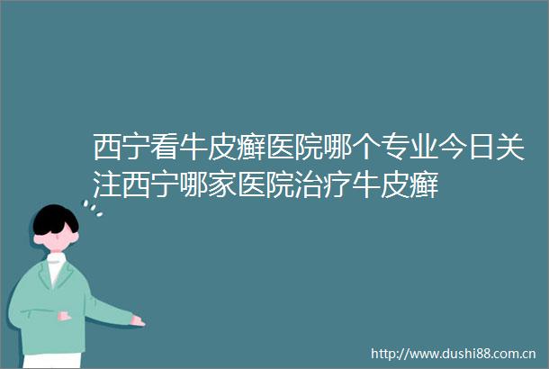 西宁看牛皮癣医院哪个专业今日关注西宁哪家医院治疗牛皮癣