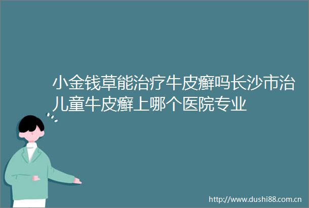 小金钱草能治疗牛皮癣吗长沙市治儿童牛皮癣上哪个医院专业
